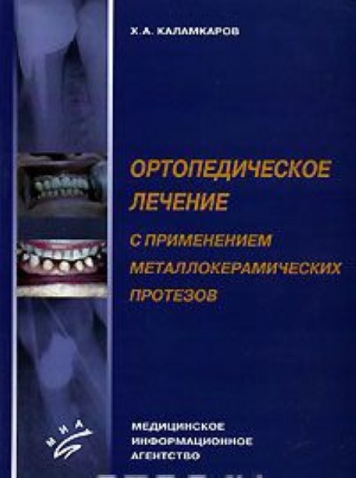 Ортопедическое лечение. Книги по ортопедической стоматологии. Ортопедическая стоматология книга. Стоматология ортопедическая книжки. Учебник по ортопедической стоматологии Каламкаров.