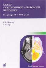 Атлас секционной анатомии человека на примере КТ- и МРТ- срезов. В 3 томах. Том 1. Голова и шея