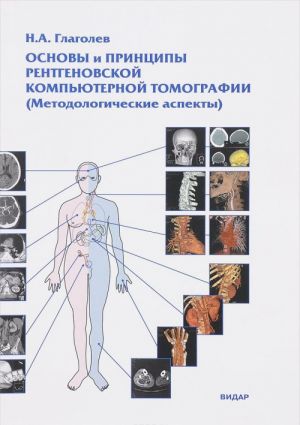 Основы и принципы рентгеновской компьютерной томографии. Методологические аспекты