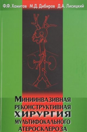 Миниинвазивная реконструктивная хирургия мультифокального атеросклероза